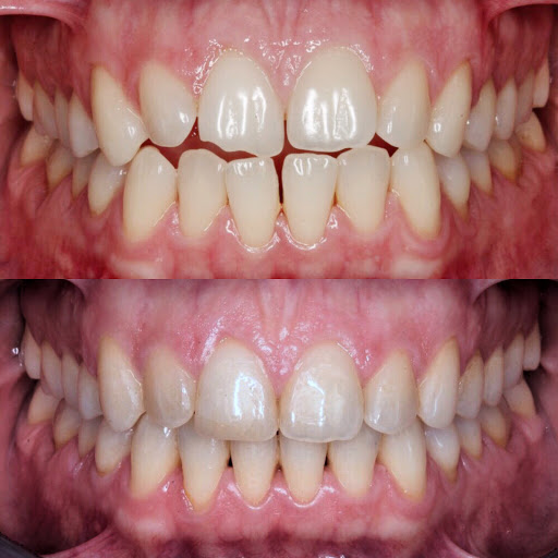 AE Clínica Dental en Gràcia. Ortodoncia Invisible. Rehabilitación oral. Periodoncia e Implantes.