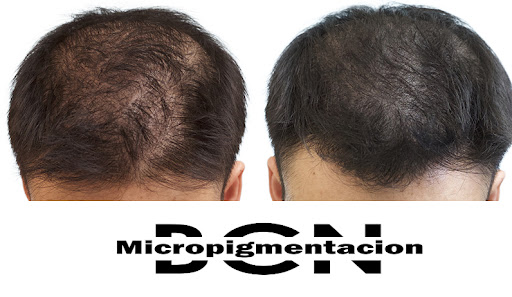 Micropigmentacion Barcelona