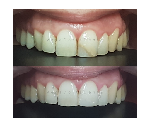 VegaDortaDental Dentista Barcelona Implantes dentales Urgencias Dentales Endodoncia Ortodoncia