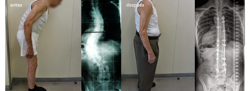 Barcelona Spine Institute - Institut de la columna vertebral