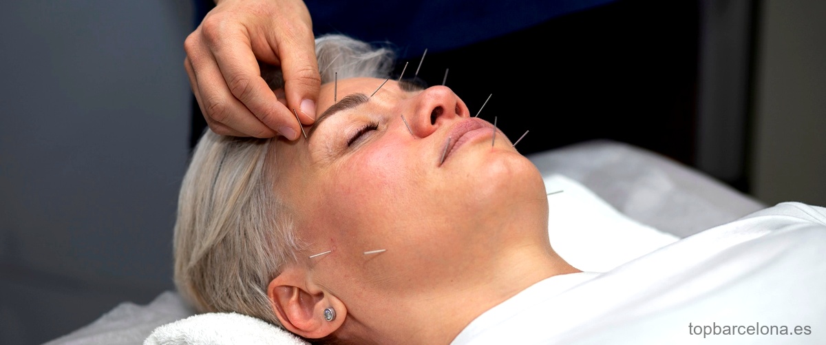 Mitos y realidades sobre la acupuntura